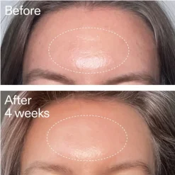 Anti-Agingserum^The INKEY List Advanced Retinal Serum