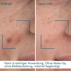 Antirimpelcrème^Biotherm Blue Retinol Resurface + Repair Night Serum