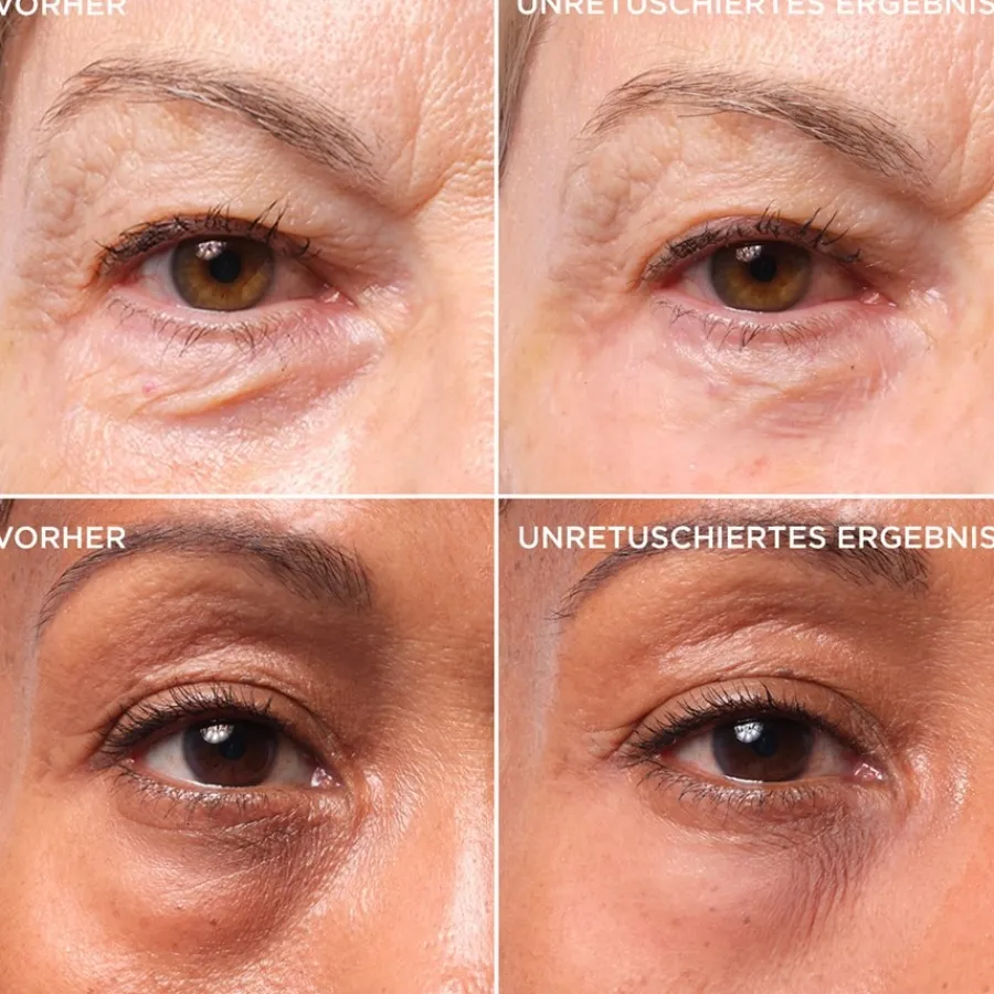 Oogcrème^it Cosmetics Bye Bye Under Eye Bags