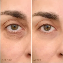 Oogcrème^Foreo C - Concentrated Eye Cream