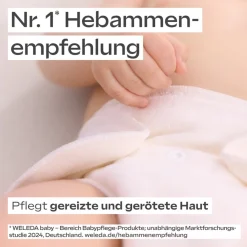 Heren|Hand & Voet^WELEDA Calendula wondbeschermende crème, Verzorgt en beschermt de babyhuid tegen pijn in de luierstreek