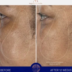 Hydraterend Serum|Anti-Agingserum^Augustinus Bader De navulling van Serum Nomad