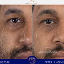 Hydraterend Serum|Anti-Agingserum^Augustinus Bader De navulling van Serum Nomad