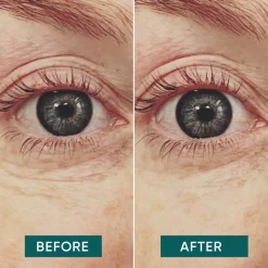 Oogmaskers & -Pads^APRICOT Eye pads with vitamin C - glow getter