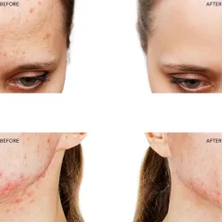 Gezichtspeeling^Foreo Fuchsia