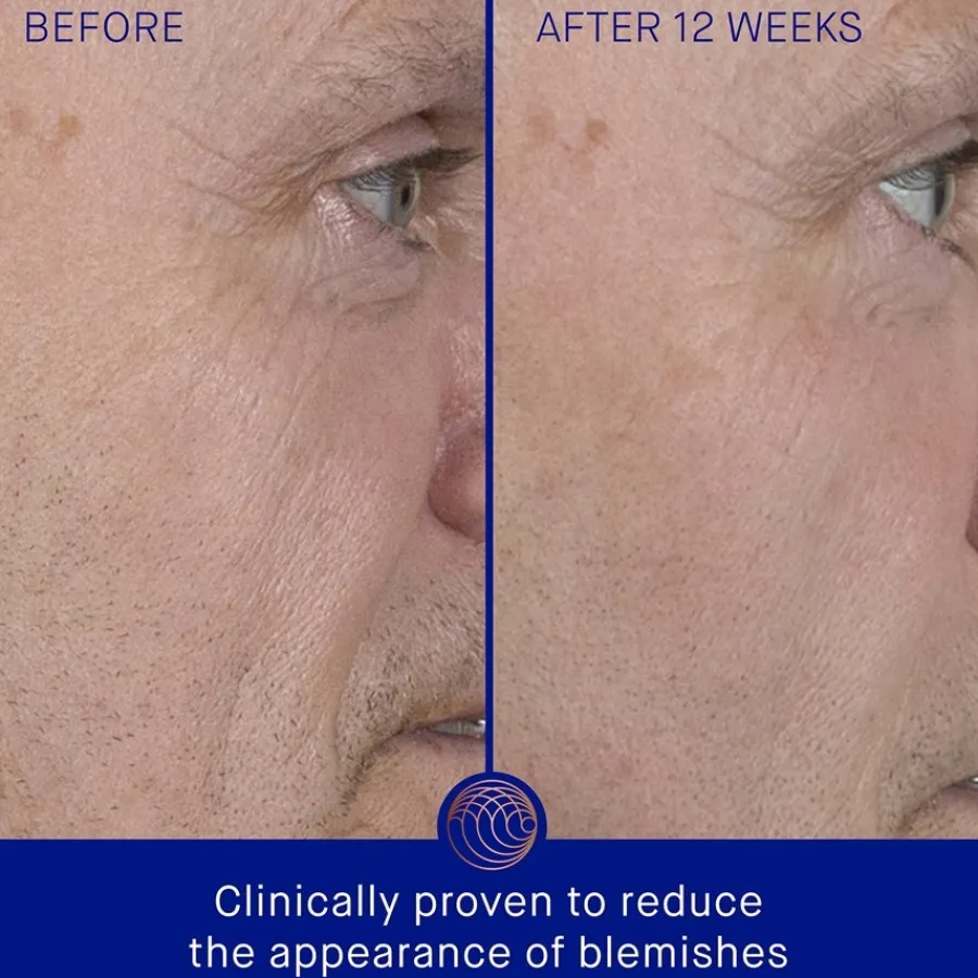 Anti-Agingserum^Augustinus Bader Het serum