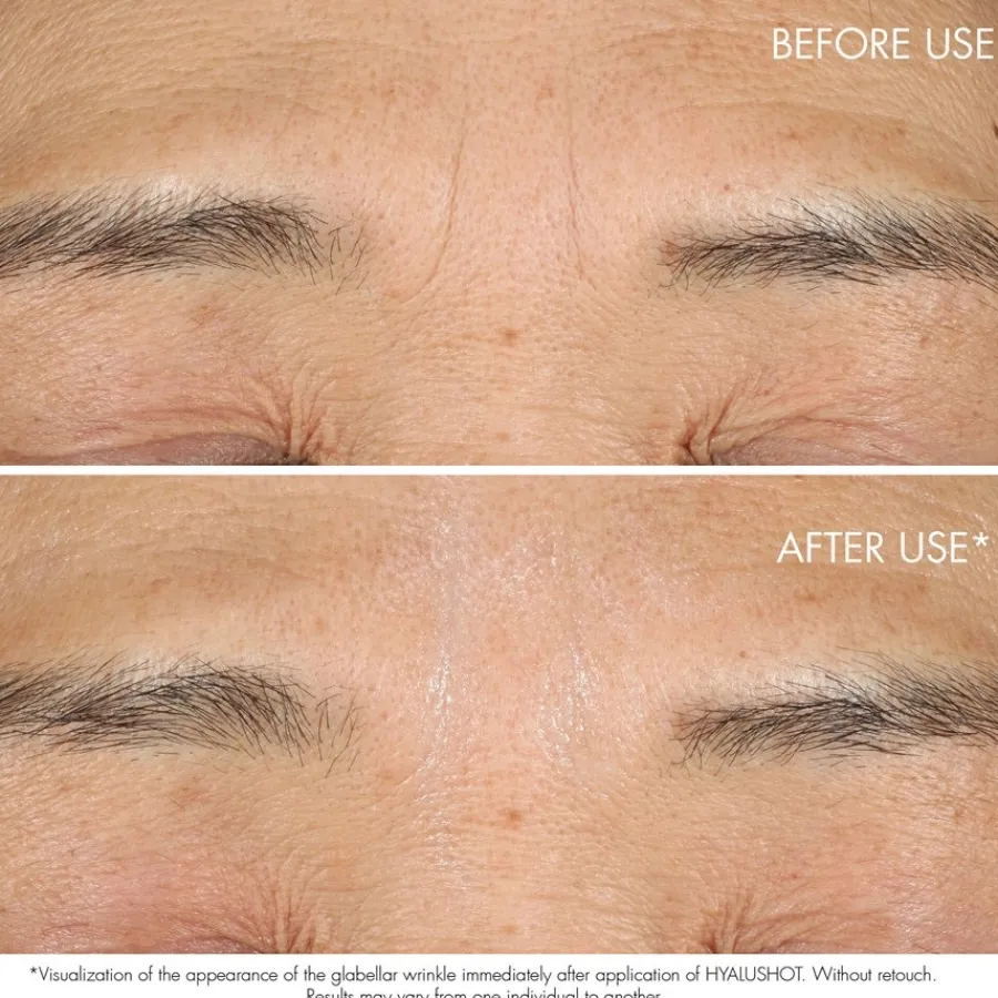 Hydraterend Serum|Anti-Agingserum^DIOR Hyalushot, Rimpel Corrector voor Bestaande & Beginnende Rimpels