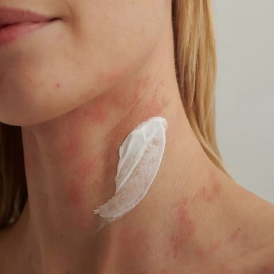 Dado Sens|Gezichtsverzorging^DADO SENS INTENSIEVE CRÈME, - Voor droge huid en neurodermitis