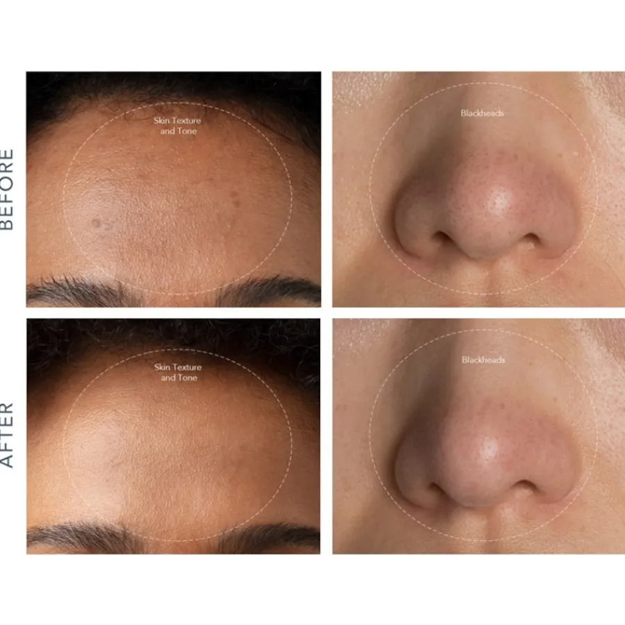 Make-Upspiegels|Gua Sha^Foreo Kiwi