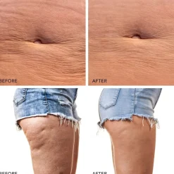 Massageborstels|Cellulitis Creme^Foreo Lavender