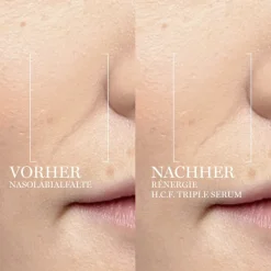 Vitamine C-Serum|Hyaluronzuurserum^Lancôme Rénergie H.C.F. Triple Serum