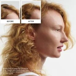 Haarserum^Nioxin Scalp & Hair Treatment, Natural Hair Light Thinning