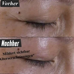 Oogcrème^Kiehl's Super Multi-Corrective Eye Zone Treatment