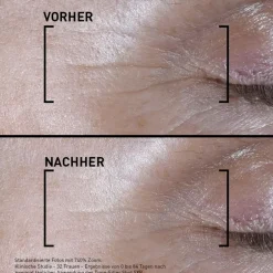 Anti-Agingserum^Filorga Time-Filler Shot 5XP