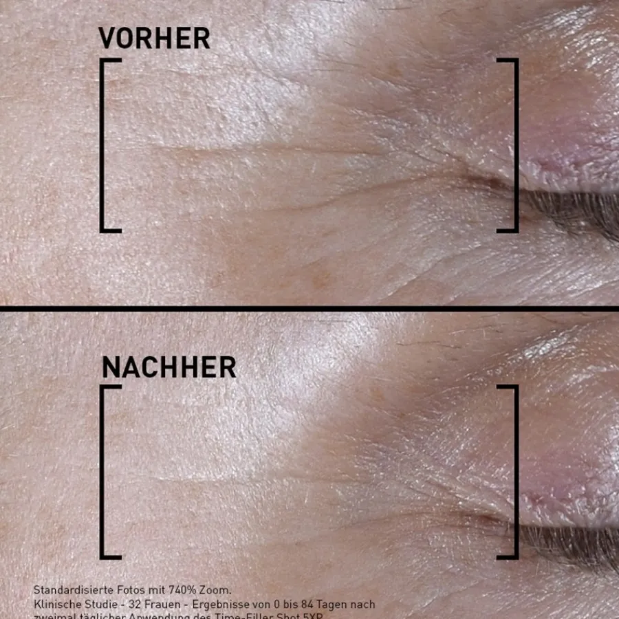 Anti-Agingserum^Filorga Time-Filler Shot 5XP