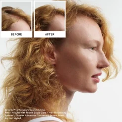 Hydraterende Conditioner|Droog Haar^Nioxin 3-traps set