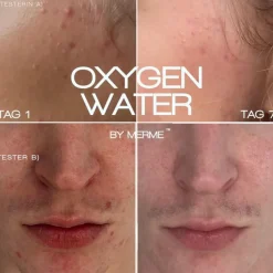 Gezichtstoners^MERME Berlin Zuurstofwater van Merme 4-weeks set